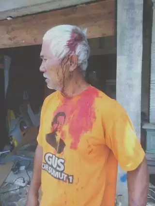 Tak Terima Ditegur, Mantan Kadus VIII Dibacok Pengusaha Ban