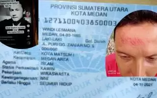 Korban Aniaya Ngaku Di Fitnah !  Pertanyakan Laporan Pengaduan ke  Polsek Medan Area