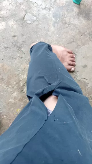 Warga Jadi Korban Gigitan Anjing, Pemkab Kuansing Diminta Turun Tangan